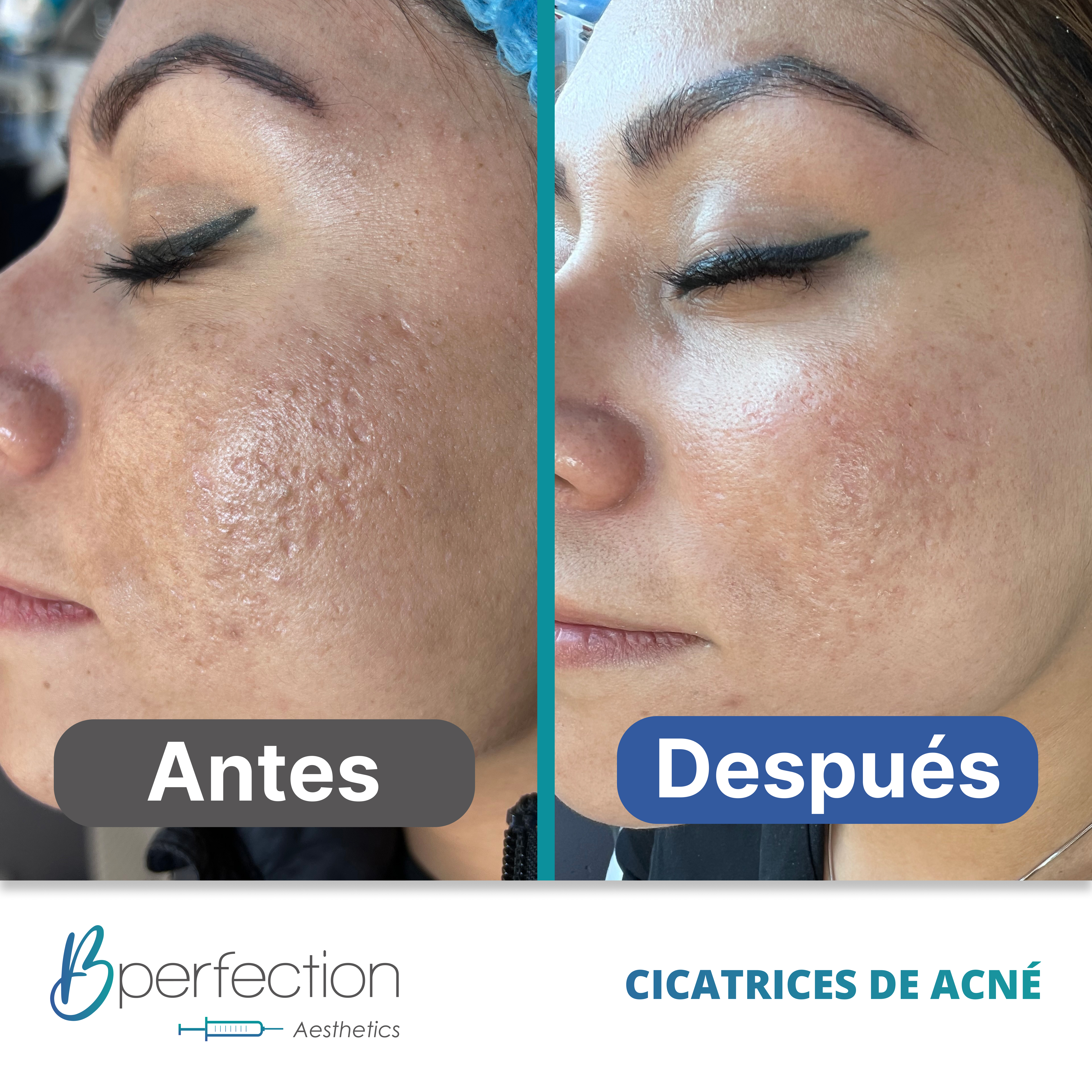 Resultado Cicatriz 6