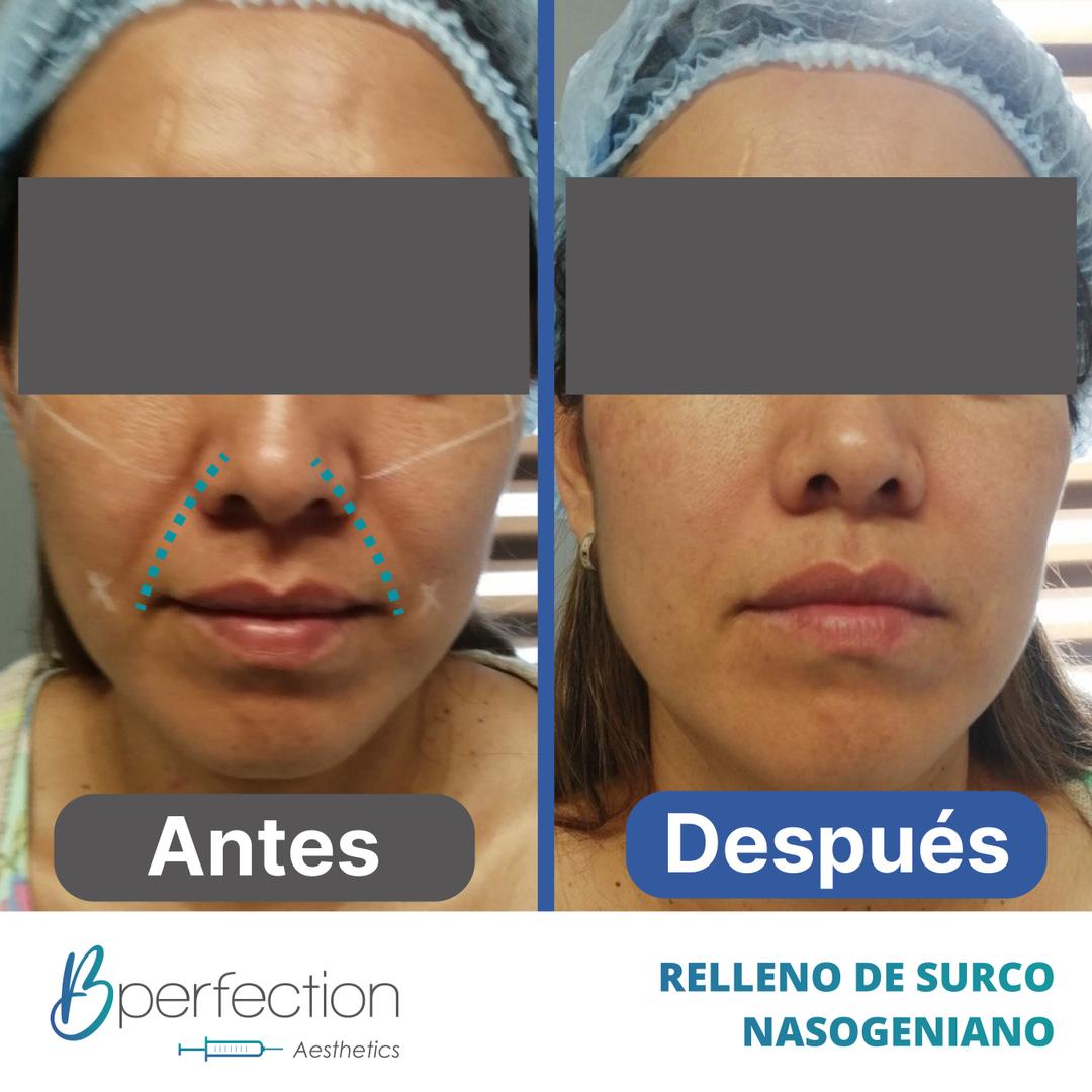 Imagen de resultado